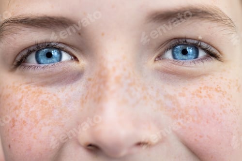 Preview: Close-up photo. Body part. Young happy and joyful face in freckles, blue eyes of a child, teenager