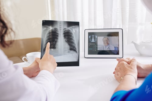 Preview: Pulmonologist checking lungs x-ray