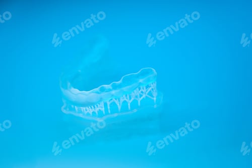 Preview: Impression of clear aligner to correct overbite