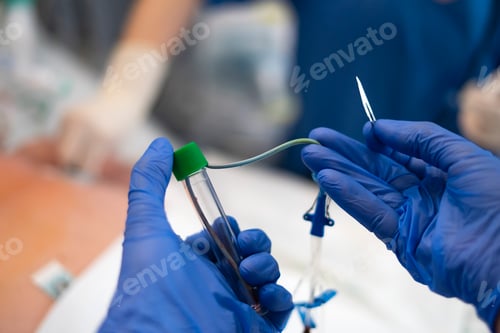 Preview: Close-up of gloved hands preparing catheter and scalpel for surgery