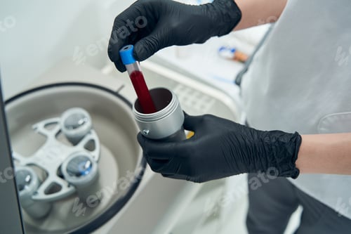 Preview: Female doctor hands holding test tube with blood