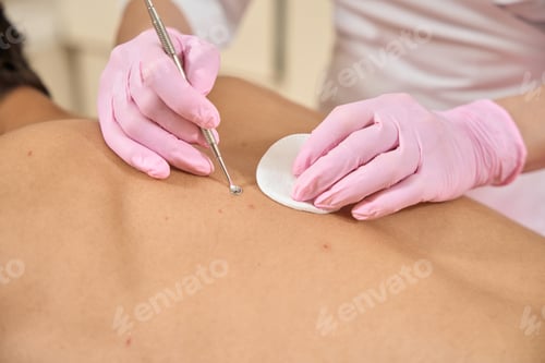 Preview: Specialist cosmetologist cleanses the skin of a clients back
