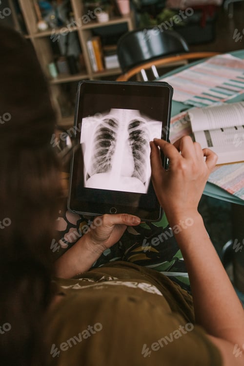 Preview: Girl analyzing a chest radiography on a tablet