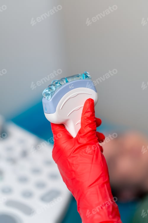 Preview: close-up the clinic gynecological office ultrasound machine with lubricant applied