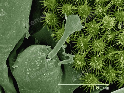 Preview: Coloured SEM of stinging hairs on saddleback caterpillar (Acharia sp., Limacodidae)