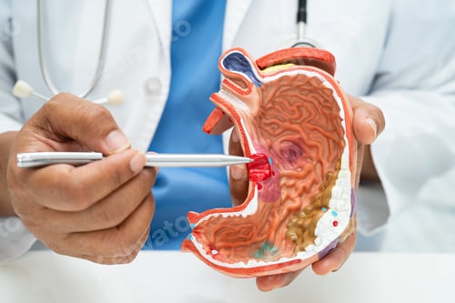 Preview: Stomach disease, doctor with human anatomy model for study diagnosis and treatment in hospital.