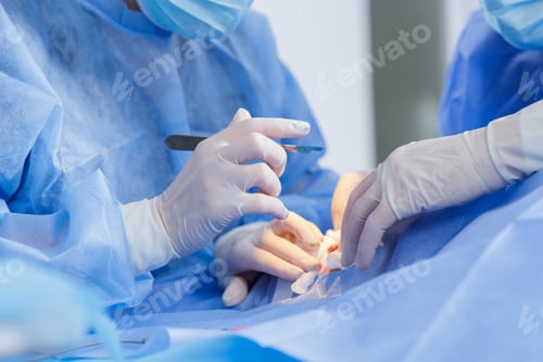 Preview: Skilled Surgeons Performing Delicate Operation with Precision