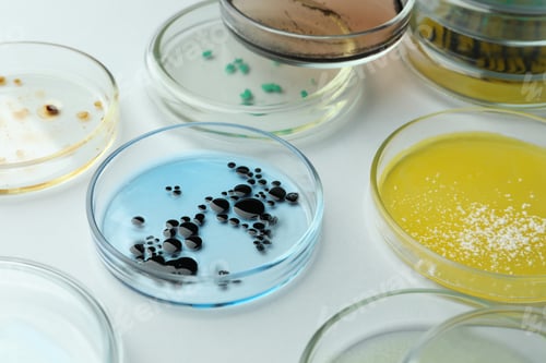 Preview: Petri dishes with different bacteria colonies on white background, closeup