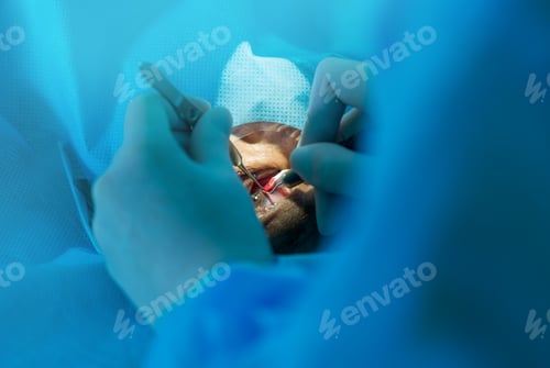 Preview: ophthalmologist performs an operation on the patient's eye