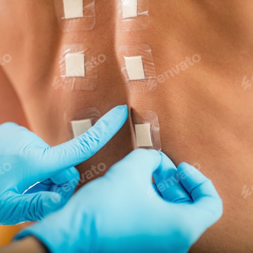Preview: Doctor Doing Skin Allergy Test