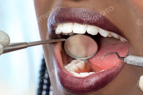 Preview: Mouth of african woman with hatchet and mouth mirror.