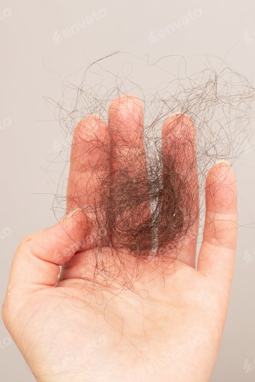 Vista previa: close up photo of female hand holding lost hair in hand on a beige background.