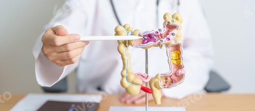 Preview: Doctor with human Colon anatomy model.