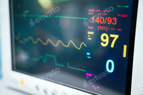Preview: Ekg machine in hospital emergency room used for heart attack diagnosis