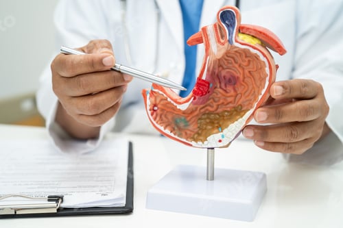 Preview: Stomach disease, doctor with human anatomy model for study diagnosis and treatment in hospital.
