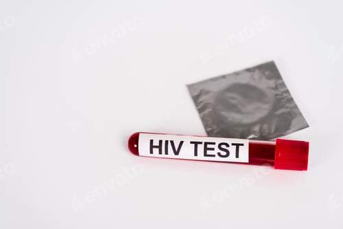 Preview: sample with hiv test near condom in pack isolated on white