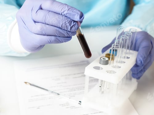 Preview: Blood Sample Analysis in Medical Lab