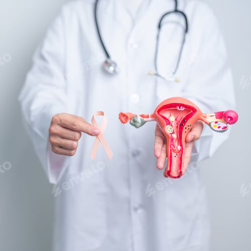 Preview: Doctor holding Peach ribbon with Uterus and Ovaries model for September Uterine Cancer Awareness