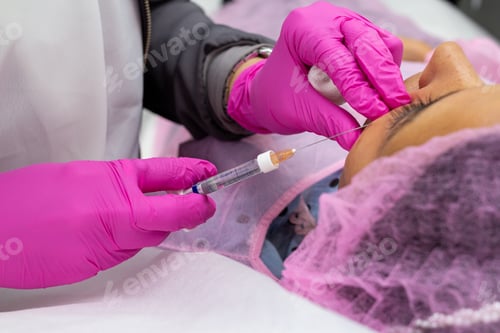 Preview: Closeup injection on a young woman's face to tighten the skin and fill in facial wrinkles