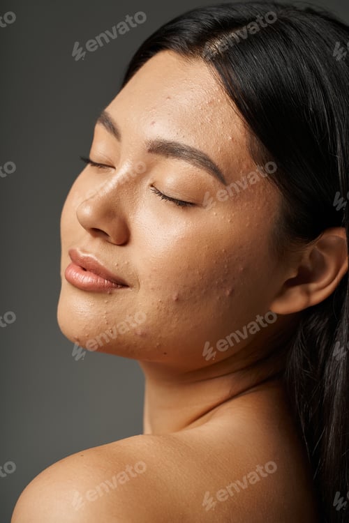 Preview: young asian woman with skin issues and bare shoulders smiling with closed eyes on grey backdrop