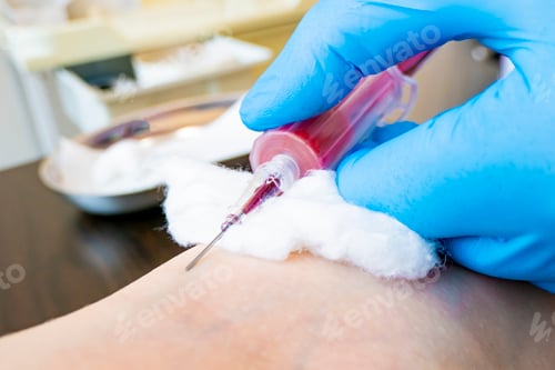 Preview: Close up blood test from vein