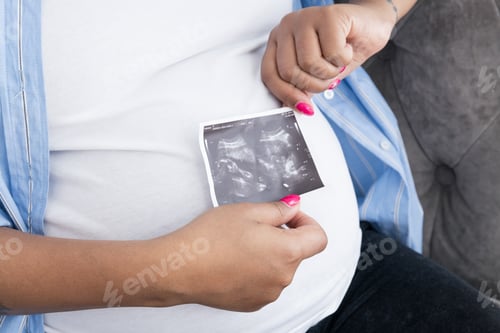 Preview: Pregnancy concept, woman holding ultrasound image.