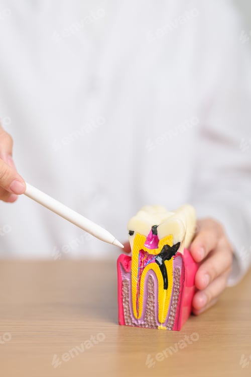Preview: Dentist with tooth Anatomy model. Oral Teeth decay
