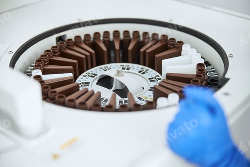 Preview: Lab worker and an open biochemistry analyzer