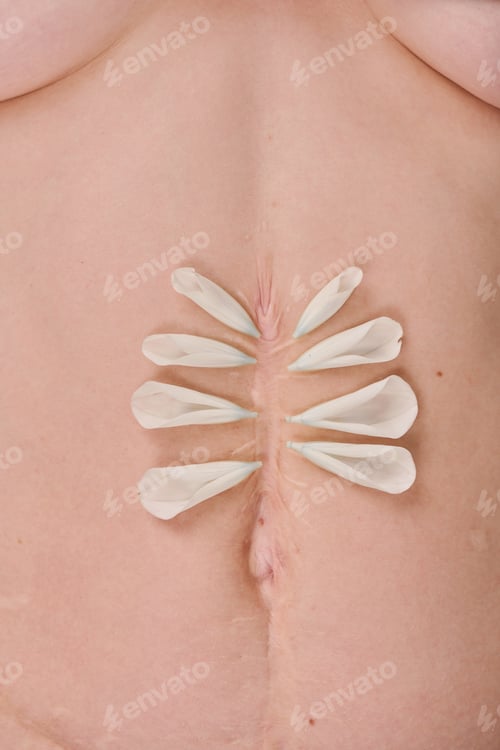 Preview: Female body with surgical scar