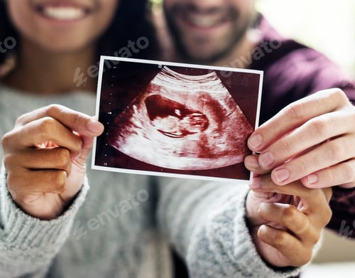 Preview: Happy couple with pregnancy news