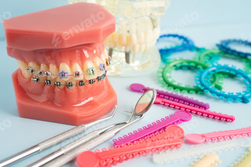 Preview: Orthodontic ligatures rings and ties, elastic rubber bands on orthodontic braces