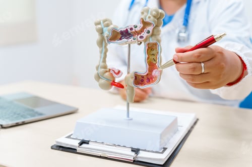 Preview: A doctor holds a human colon anatomy model, demonstrating the digestive system