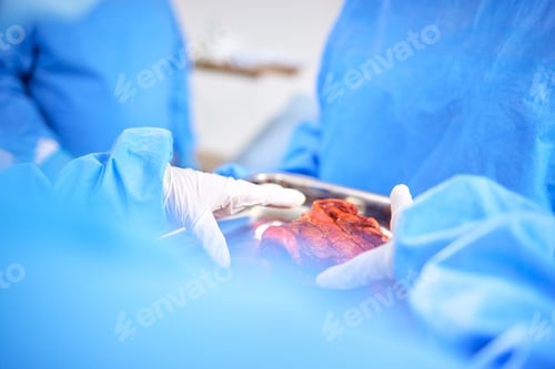 Preview: Organ transplant, hands and doctor surgery, medical support or teamwork on liver, healing accident