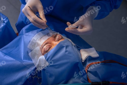 Preview: close-up eyes after eye surgery , blepharoplasty operation, plastic surgeon