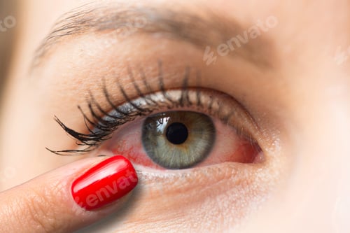 Preview: Finger pointing woman red eye