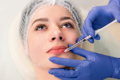 Preview: A beautiful woman receives a filler injection on the lips. Young woman receiving a botox injection