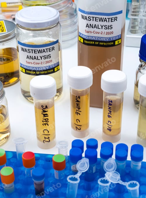 Preview: Investigation of sars-cov-2 virus in humans in a wastewater laboratory, conceptual image