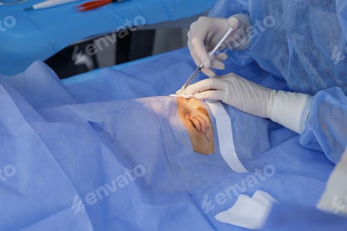 Preview: Eyelid blepharoplasty injection for local anesthesia under sterile drapes in clinic