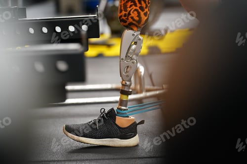 Preview: Young female with one prosthetic leg with exercise by walking on a treadmill to practice walking