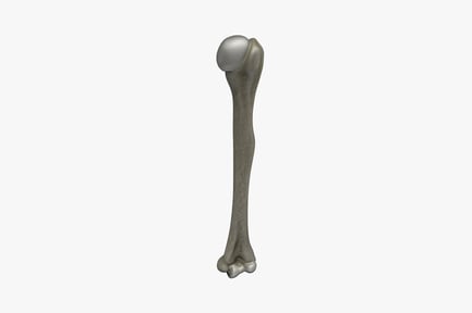 Preview: Femur lateral view in standing position
