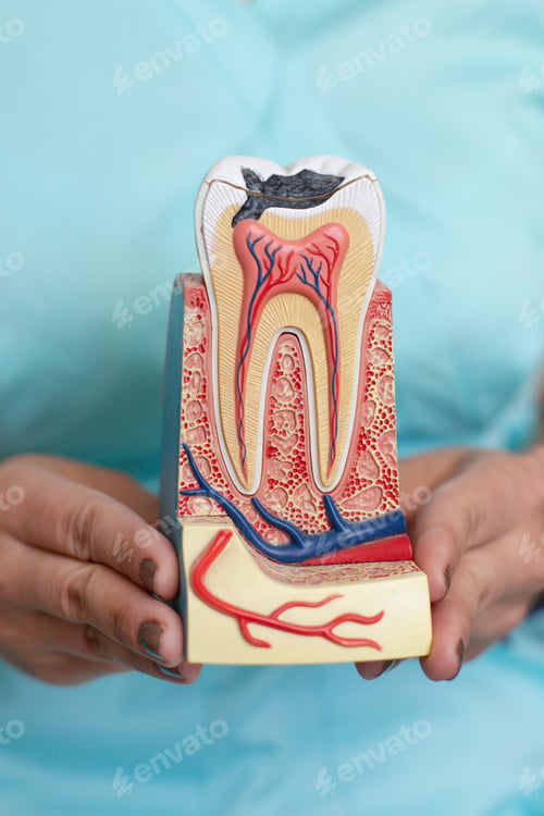 Preview: Model of imitation of a tooth incision with caries and canals for treatment in the hands of a dentis