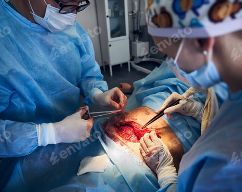 Preview: Surgeons Performing Operation in Operating Room