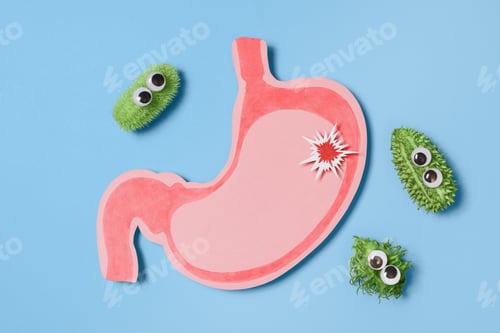 Preview: Cartoon Stomach Infection With Bacteria Surrounding It