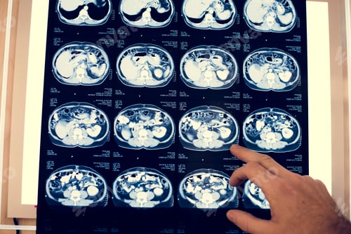 Preview: Brain CT scan x-ray film