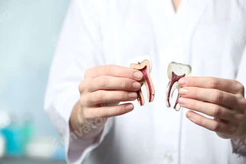 Preview: Dentist holding model of tooth on blurred background, closeup