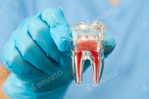Preview: Asian dentist holding dental implant, artificial tooth roots into jaw, root canal