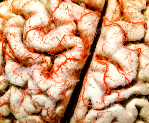 Preview: Human brain closeup