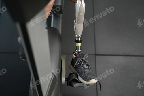 Preview: Stay active, Young woman with bionic leg exercise in fitness. healthy and sport concept.