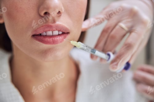 Preview: Charming female getting mouth contouring with filler injection