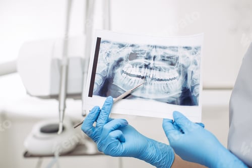 Preview: Dentist showing X-ray image to patient